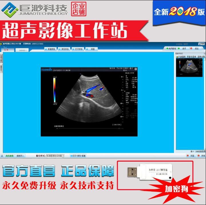 b超工作站 超聲影像工作站 彩超圖文工作站 醫(yī)學影像工作站軟件