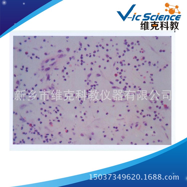人肉芽組織切片 生物切片  人體病理學(xué)類 細(xì)胞和組織損傷修復(fù)