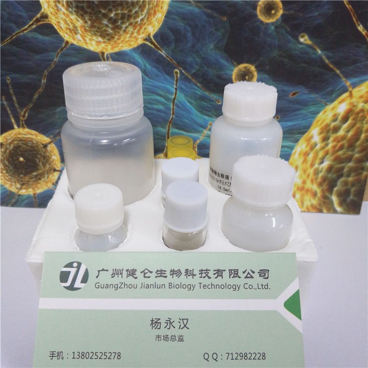 甲型H1N1流感病毒RNA檢測試劑盒（PCR-熒光探針法）甲型流感檢測