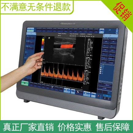 保健品檢測多普勒設備 血流斑塊心血管超聲波診斷儀B超/會銷設備