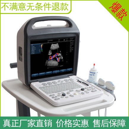 會(huì)銷老年人心腦血管頸動(dòng)脈多普勒斑塊彩超機(jī) 超聲波健康檢測(cè)儀