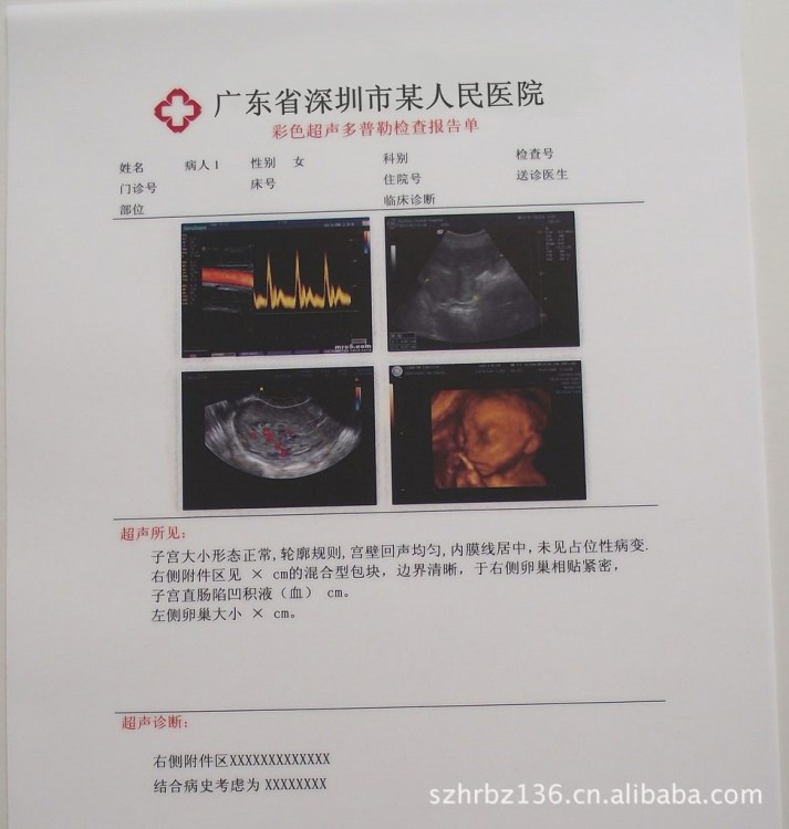 供應(yīng)激光打印膠片、B超打印膠片