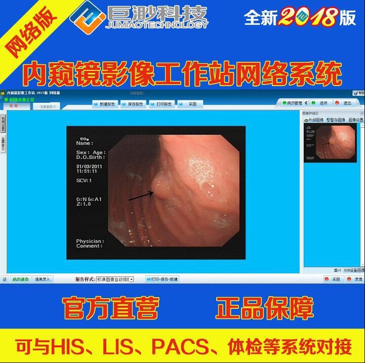 內窺鏡影像工作站網絡系統(tǒng) 耳鼻喉工作站網絡版 宮腹腔鏡網絡系統(tǒng)