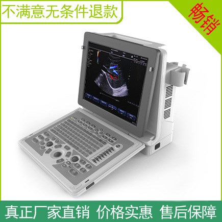 國(guó)產(chǎn)推車(chē)容積四維超聲診斷儀彩色B超 相控陣凸陣陰超
