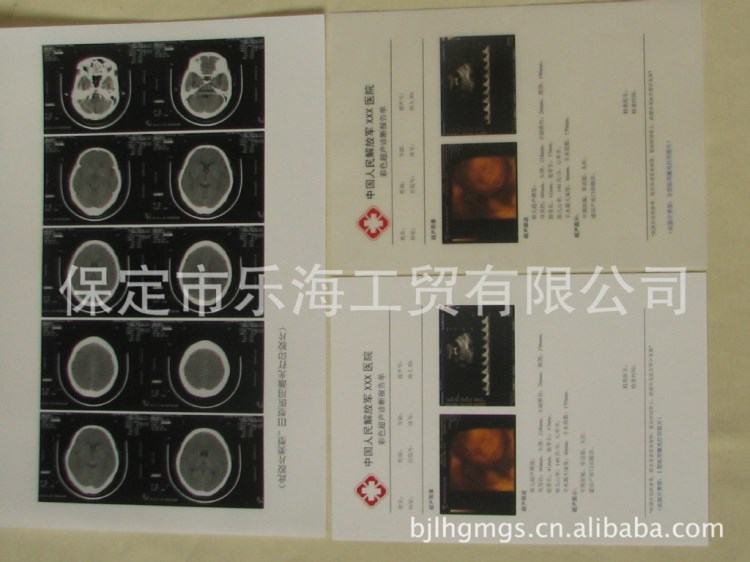 MPET新型醫(yī)用打印膠片