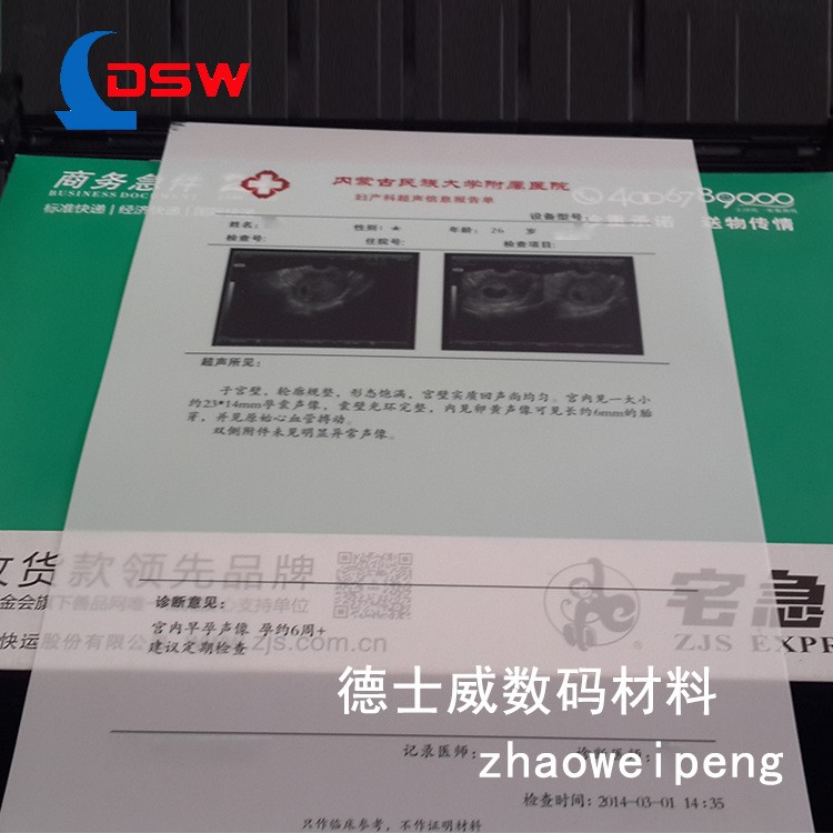 河南廠(chǎng)家批發(fā)雙面激光打印醫(yī)用膠片 四維影像膠片 量大價(jià)優(yōu)