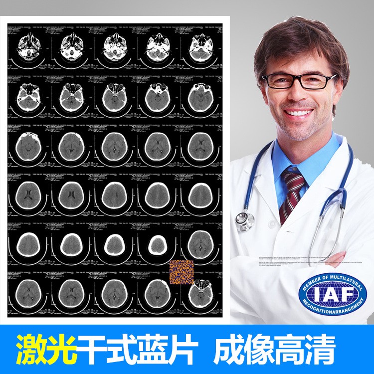 藍色激光干式醫用膠片 彩色激光膠片 X光 CR DR CT MRI放射科膠片