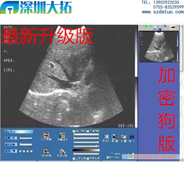 正版超声医学影像B超彩超伪彩工作站软件 随心所欲XP版