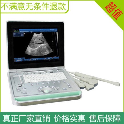 15寸全數(shù)字便攜式B超機(jī)診斷儀 三維內(nèi)置工作站可直接打印診斷報告