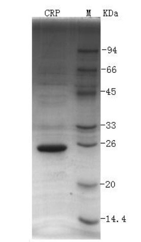 CRP抗原，人C反應蛋白，CRP（可溯源）