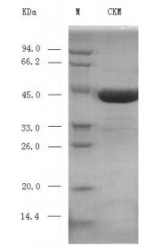 肌酸激酶同工酶（CK-MB），CK-MB，CK-MM，乳膠比濁，可溯源