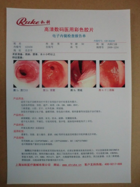 廠家批發(fā)彩超膠片 三維立體成像