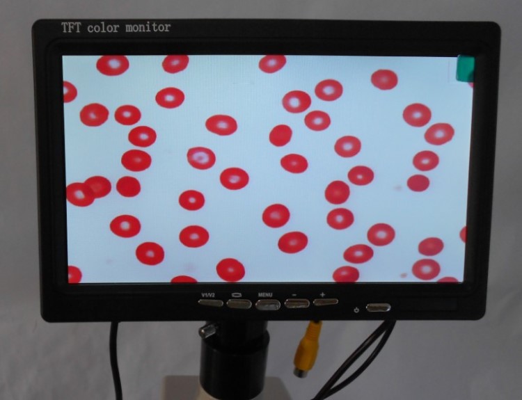 顯微鏡專用7寸高清顯示屏 一滴血高清攝像頭