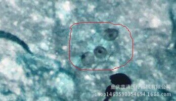 六胺銀染色液（GMS） 微生物染色液 常用染色液 實(shí)驗(yàn)室耗材